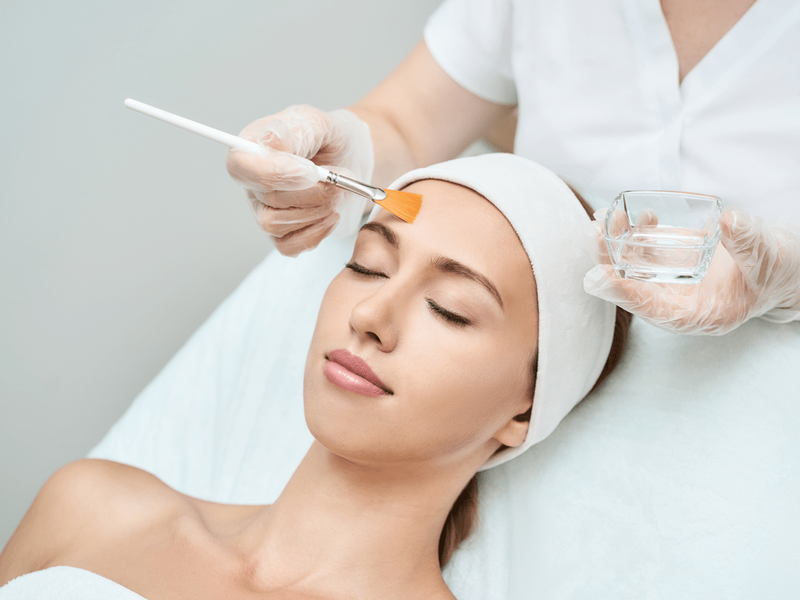 Peeling químico